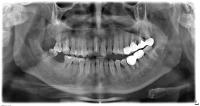 DentSeg4_Valids project thumbnail