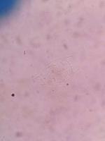 Zooplankton project thumbnail
