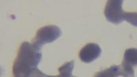 malaria cells project thumbnail