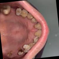 fixoklusalatas project thumbnail