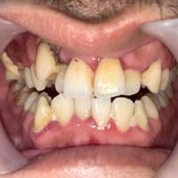 fixlabial project thumbnail
