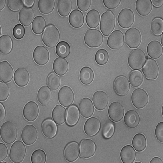 RBC_Blood_Cell Instance Segmentation Dataset by Progress