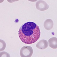 blood cell labeling Object Detection Model by liu