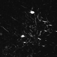 neurons project thumbnail