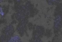 uenr_cashew_health project thumbnail