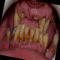 Dataset Image