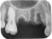 denpar-tooth-segmentation project thumbnail