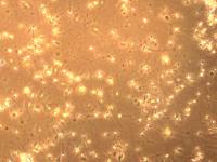 Sperm Quality  project thumbnail