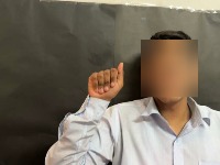Hand Classification project thumbnail