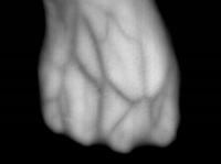 Vein project thumbnail