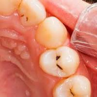 Dental-app project thumbnail