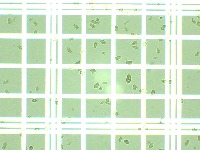Microalgae Cell 2 project thumbnail