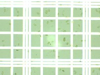 Cell counting microalgae  project thumbnail