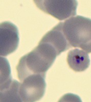 malaria2031 project thumbnail