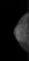 detector cancer  project thumbnail