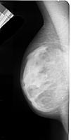 detector cancer  project thumbnail