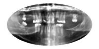 Dental Radiography2 project thumbnail