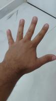 counting_finger project thumbnail