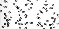 dataset2 project thumbnail