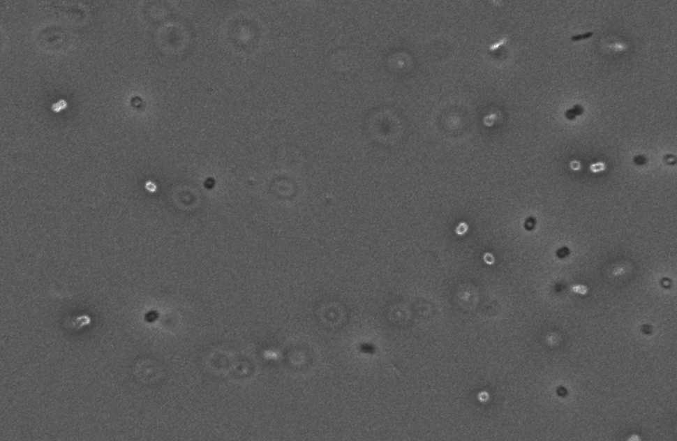 Detection bacter diff Object Detection Dataset by Maxim