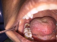 oral  project thumbnail