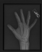 bone project thumbnail