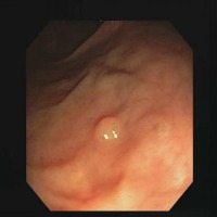 Colonoscopy Object Detection Model by verdant