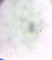 MVP For Urine Microscopy project thumbnail