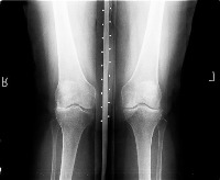 knee-joint-localization-7shot project thumbnail