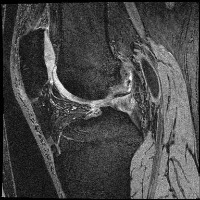KneeJoint-SagittalMRI project thumbnail