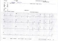 ECG project thumbnail