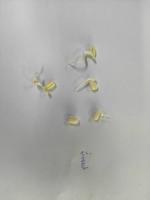 bean sprouts object detection project thumbnail
