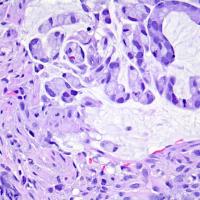 Colon_Detection project thumbnail