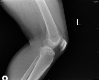 Knee Lateral Graphy project thumbnail