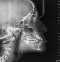 Cephalometric Autolandmarking project thumbnail