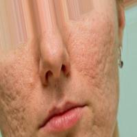semantic project thumbnail