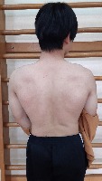 AI spinecheck project thumbnail