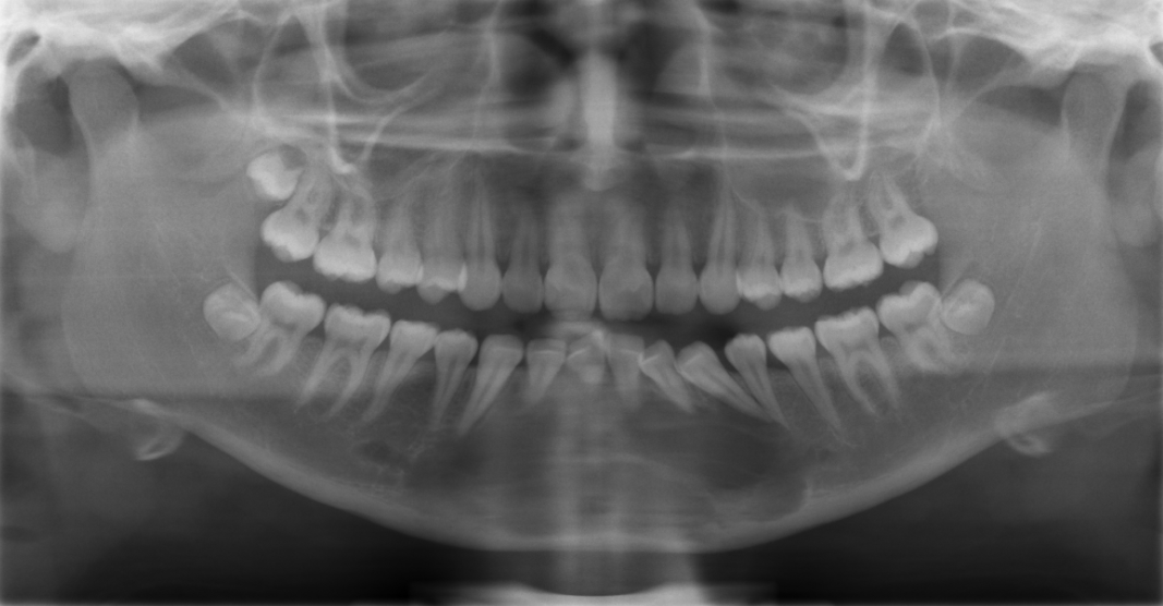 Carcinoma 2C Object Detection Dataset by Test