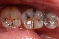 dentify project thumbnail