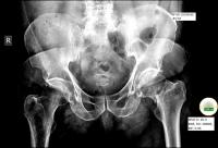 spine_bone_naming project thumbnail