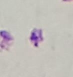 Sperm Segmentation project thumbnail