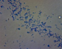 E-coli 1500x project thumbnail