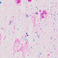 5bacteria_v1 project thumbnail