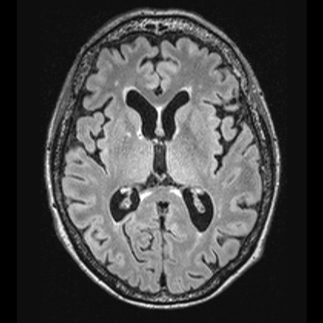 brain Classification Model by grace