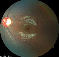Dataset Image