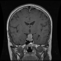 Medical Image Detection project thumbnail