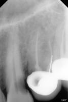 Cavity_OM_Exclusion_1&2_26_09 project thumbnail