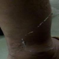 dermatitis 2 project thumbnail