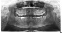 periapical project thumbnail