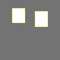 chest x ray images3 Object Detection Dataset and Pre-Trained Model by Willy